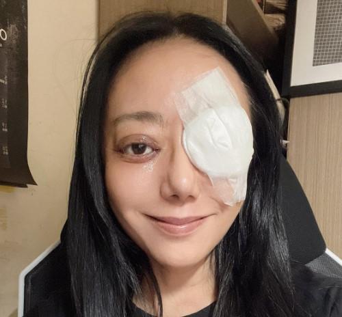 高慧君甲狀腺異常致斜視！醫：女性罹病風險為男性7倍