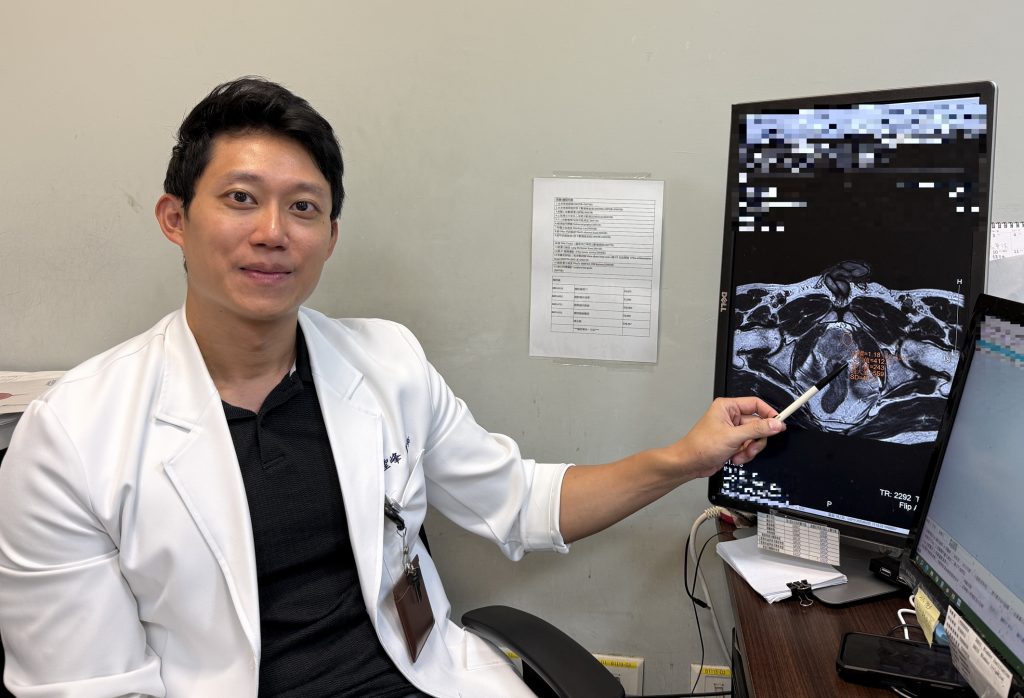 早期攝護腺癌 海扶刀無創治療除患