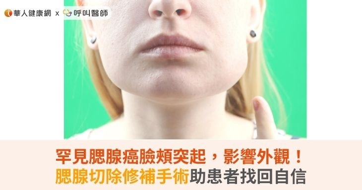 罕見腮腺癌臉頰突起，影響外觀！腮腺切除修補手術助患者找回自信